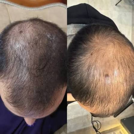 شامپو ماه سو حاوی عصاره سبوس برنج 250 میل - Image 3
